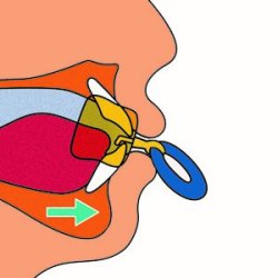 Mundskrm lbe- og tungetrner med kappe small